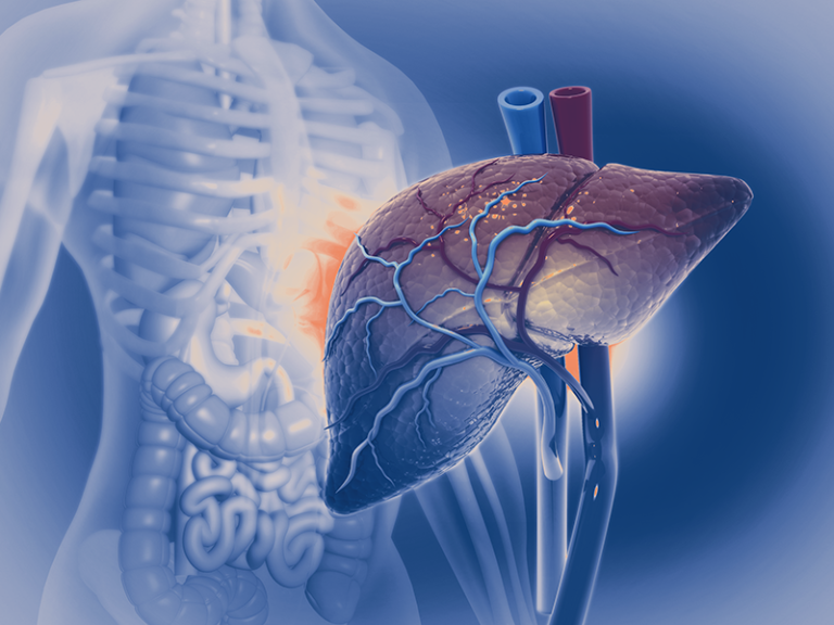 Hepatobiliary Cancer  Navigating the Complex Landscape of Liver and Bile Duct Cancers.