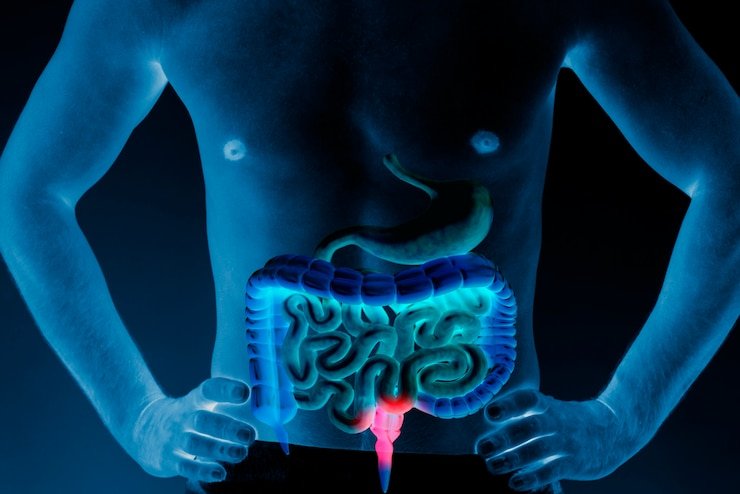 Colorectal Cancer: Understanding the Risks, Symptoms, and Treatment Options