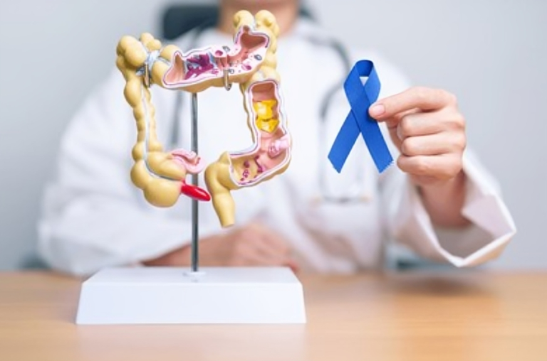 New Study Finds Colorectal Cancer Rates Rising In Younger Adults