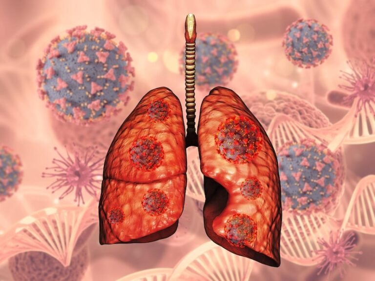 Steps to Finding the Top Lung Cancer Specialist in Shalimar Bagh.