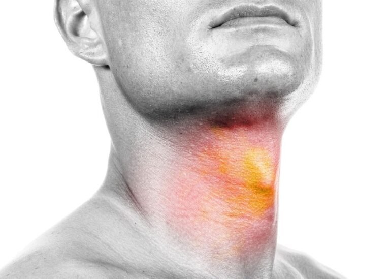 Neck Cancer Treatment in Shalimar Bagh: Comprehensive Guide to Recovery and Care