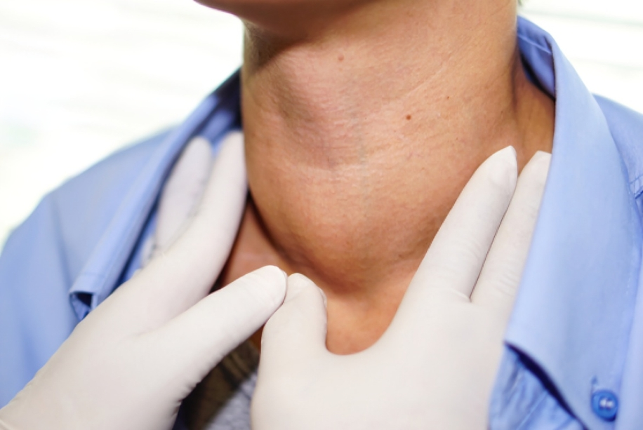 Swollen-neck