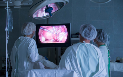 Laparoscopy-Treatment