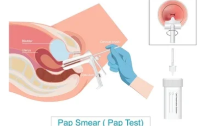 Pap-Smear-HPV-Testing